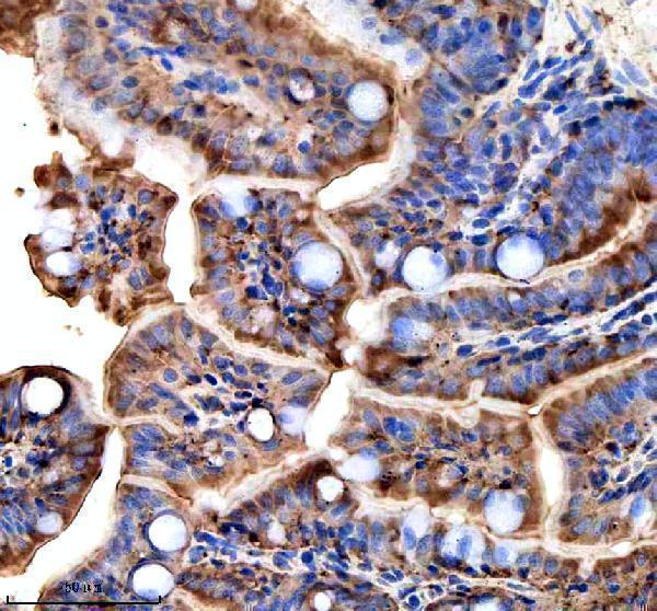 Anti-Zebrafish TTC7B Antibody Boster Bio