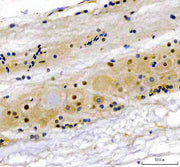 Anti-Zebrafish NSUN5 Antibody Picoband®