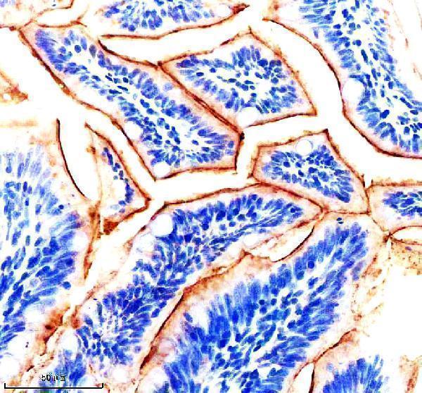 Anti-Zebrafish IGF1RA Antibody Boster Bio