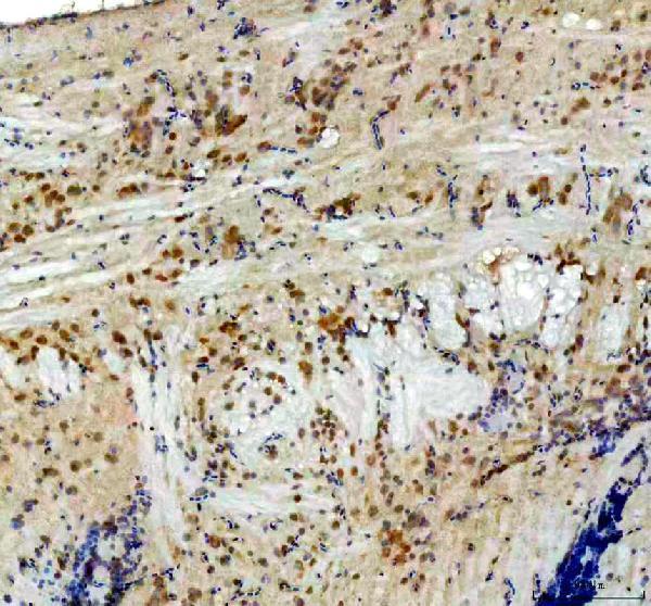 Anti-Zebrafish CYP11C1 Antibody Boster Bio