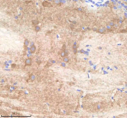 Anti-Zebrafish PARD3aa Antibody Boster Bio