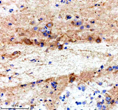 Anti-Zebrafish TTC28 Antibody Boster Bio