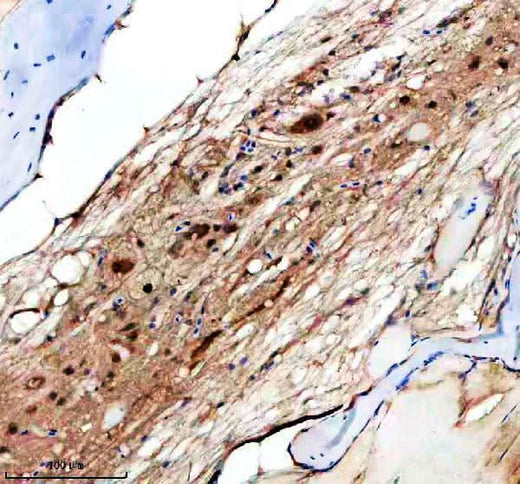 Anti-Zebrafish HS2ST1a/b Antibody Boster Bio
