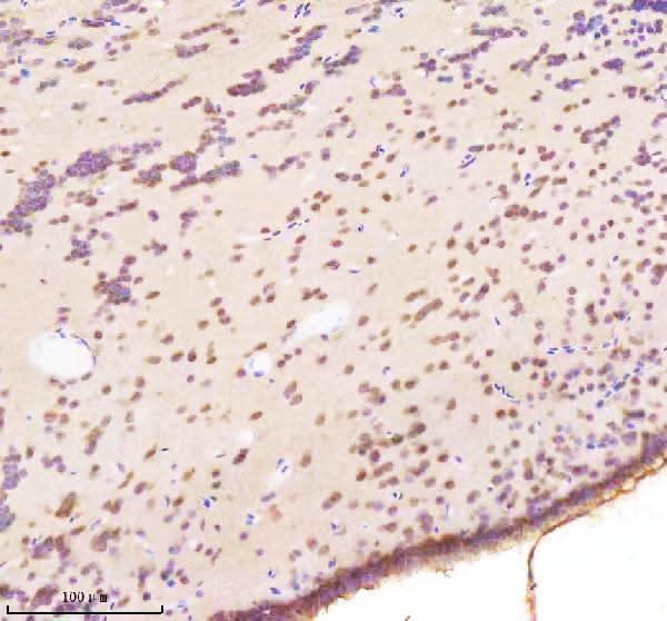 Anti-Zebrafish BAP1 Antibody Boster Bio