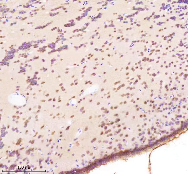 Anti-Zebrafish BAP1 Antibody Boster Bio