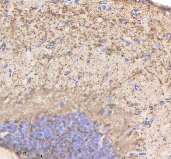 Anti-Zebrafish PHYHIPL/b Antibody Boster Bio