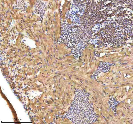 Anti-Zebrafish SREBF1 Antibody Boster Bio