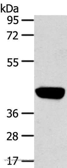 Anti-Human PRSS50 Antibody - ABMIUM