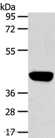 Anti-Human PRSS50 Antibody - ABMIUM