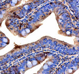 Anti-Zebrafish VPS53 Antibody Boster Bio