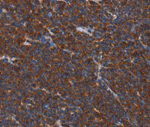 Anti-Human/Mouse/Rat FNK Antibody