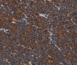 Anti-Human/Mouse/Rat FNK Antibody - ABMIUM