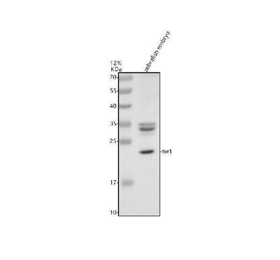 Anti-Zebrafish TIE1 Antibody Picoband® Boster Bio