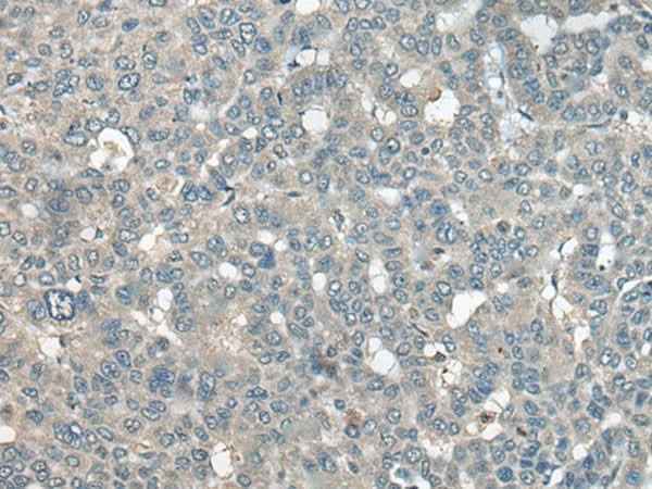 Anti-Human UCN3 Antibody