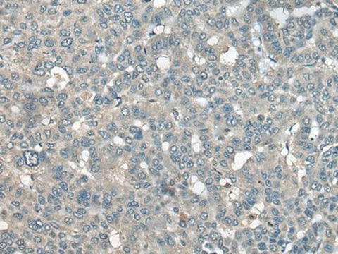 Anti-Human UCN3 Antibody - ABMIUM