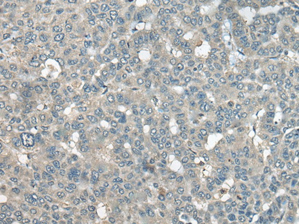 Anti-Human UCN3 Antibody - ABMIUM
