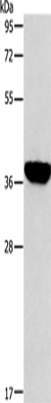 Anti-Human/Mouse/Rat ALDOB Antibody - ABMIUM