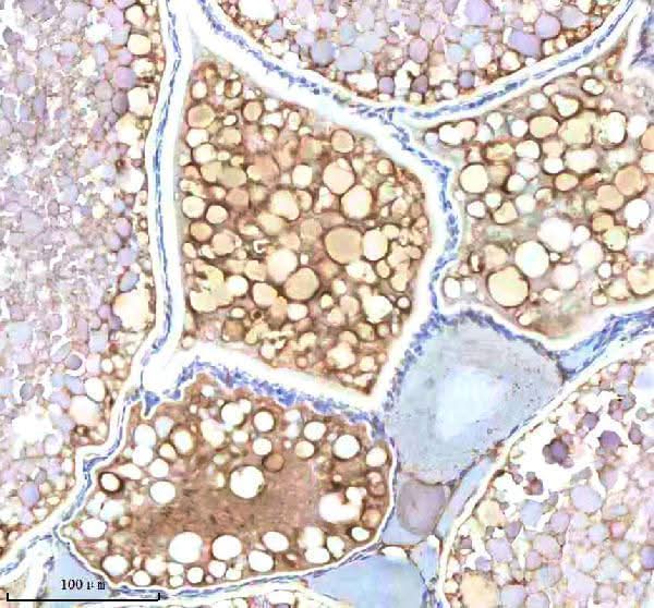 Anti-Zebrafish NDR1 Antibody Boster Bio