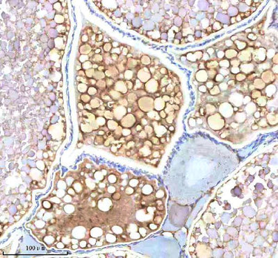 Anti-Zebrafish NDR1 Antibody Boster Bio