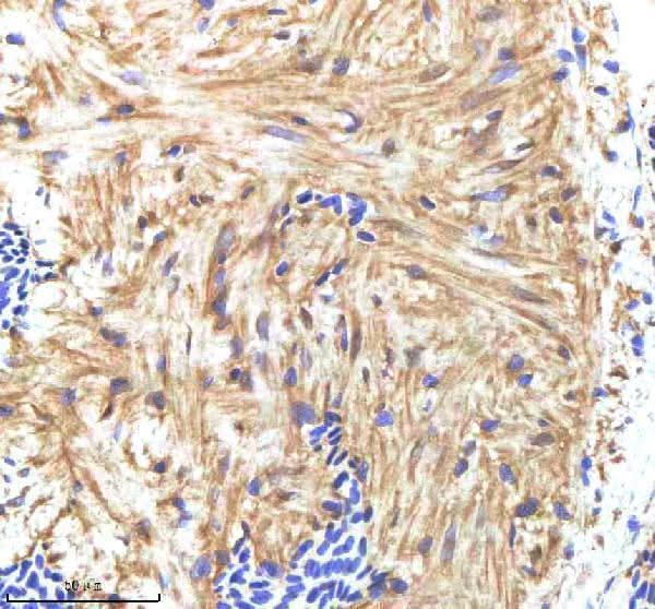 Anti-Zebrafish HAND2 Antibody Boster Bio