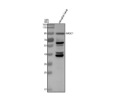 Anti-Zebrafish Glucocorticoid receptor/NR3C1 Antibody Picoband® Boster Bio