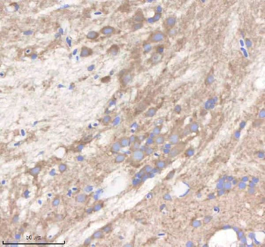 Anti-Zebrafish PI4KB Antibody Boster Bio