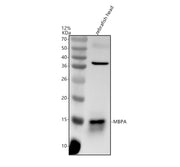 Boster AZQ5I2C7 validation image 1
