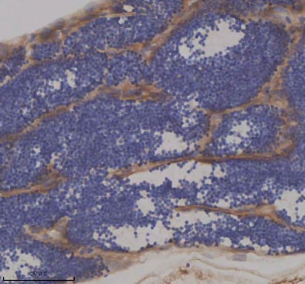 Anti-Zebrafish IFT172 Antibody Boster Bio