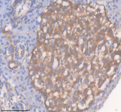 Anti-Zebrafish ACOX1 Antibody Boster Bio