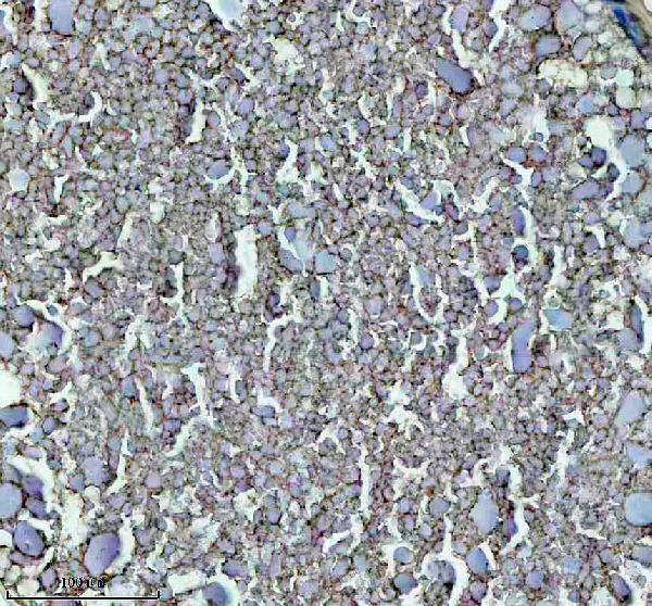 Anti-Zebrafish GNRH2 Antibody Boster Bio