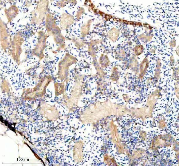 Anti-Zebrafish FHL2a/b Antibody Boster Bio