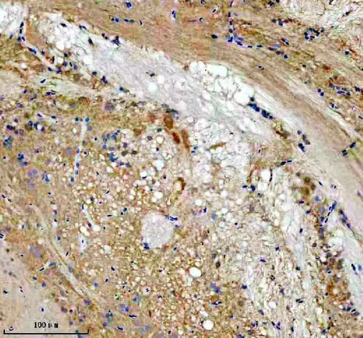Anti-Zebrafish LZIC Antibody Boster Bio
