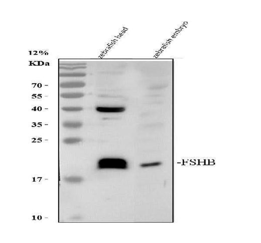 Anti-Zebrafish FSHB Antibody Picoband® Boster Bio