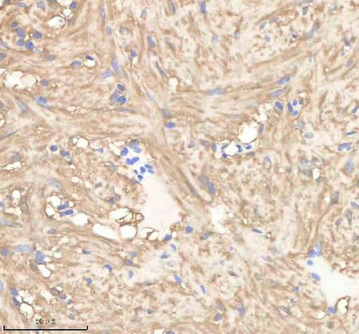 Anti-Zebrafish PGAM1a/b Antibody Boster Bio