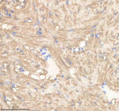 Anti-Zebrafish PGAM1a/b Antibody Boster Bio