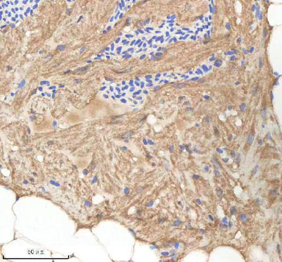 Anti-Zebrafish NPLOC4 Antibody Boster Bio