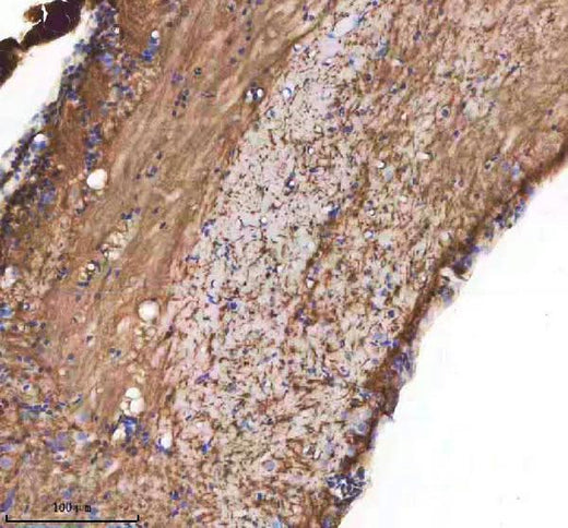 Anti-Zebrafish CXCL12A/B Antibody Boster Bio