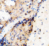 Anti-Zebrafish TBX1 Antibody Boster Bio
