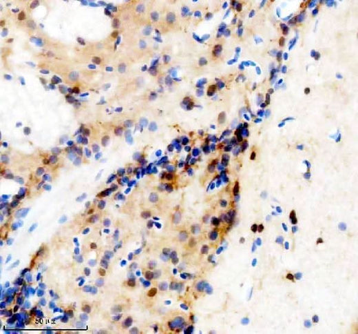 Anti-Zebrafish TBX1 Antibody Boster Bio