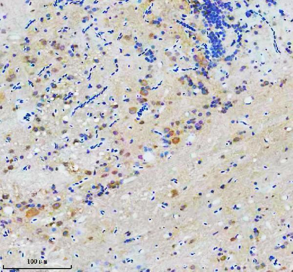 Anti-Zebrafish CCT7 Antibody Boster Bio
