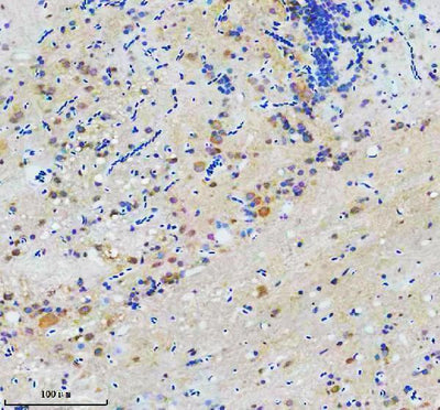 Anti-Zebrafish CCT7 Antibody Boster Bio
