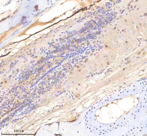 Anti-Zebrafish SF3A1 Antibody Boster Bio