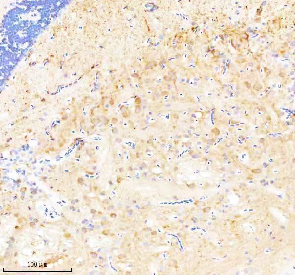 Anti-Zebrafish CASK Antibody Boster Bio