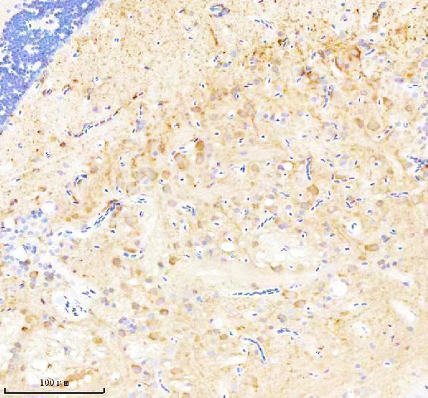 Anti-Zebrafish CASK Antibody Boster Bio