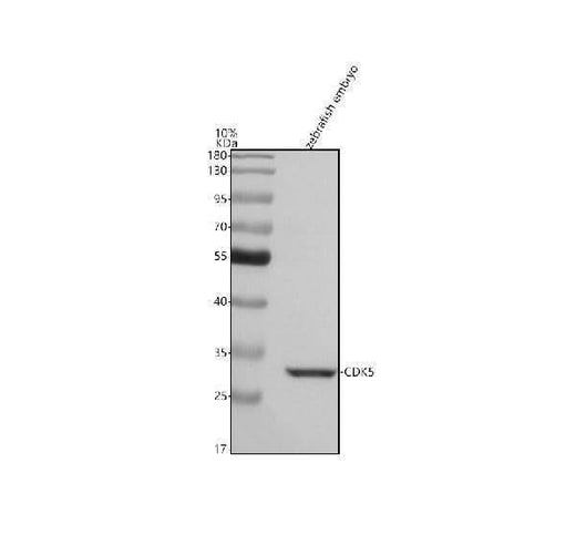 Anti-Zebrafish CDK5 Antibody Picoband® Boster Bio