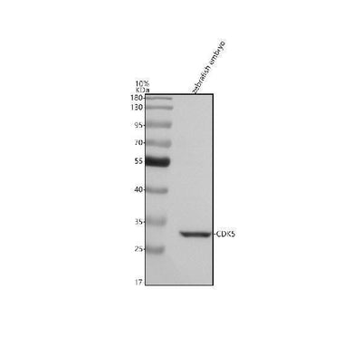 Anti-Zebrafish CDK5 Antibody Picoband® Boster Bio