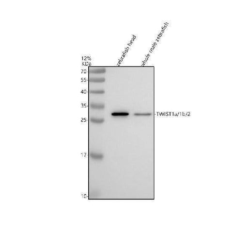 Anti-Zebrafish TWIST1A/1B/2 Antibody Picoband® Boster Bio