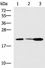 Western blot analysis of Mouse small intestines tissue Mouse kidney tissue Mouse pancreas tissue lysates using PPIC Polyclonal Antibody at dilution of 1:550