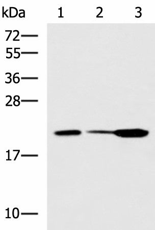 Western blot analysis of Mouse small intestines tissue Mouse kidney tissue Mouse pancreas tissue lysates using PPIC Polyclonal Antibody at dilution of 1:550
