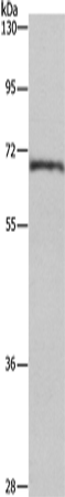 Anti-Human/Mouse/Rat CDK5RAP3 Antibody - ABMIUM